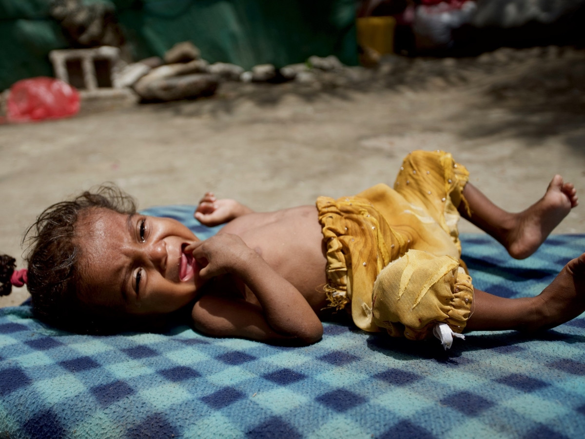 AÇLIKLA MÜCADELE EDEN ÇOCUKLARIN KARNI NEDEN ŞİŞER?