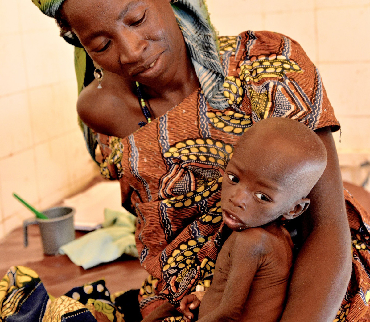 AÇLIK BİR “ÖLÜM KALIM MESELESİ”