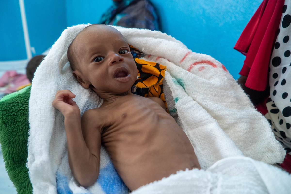 PEKİ YA HER GÜN AÇLIKTAN HAYATINI KAYBEDEN 8220 ÇOCUK?