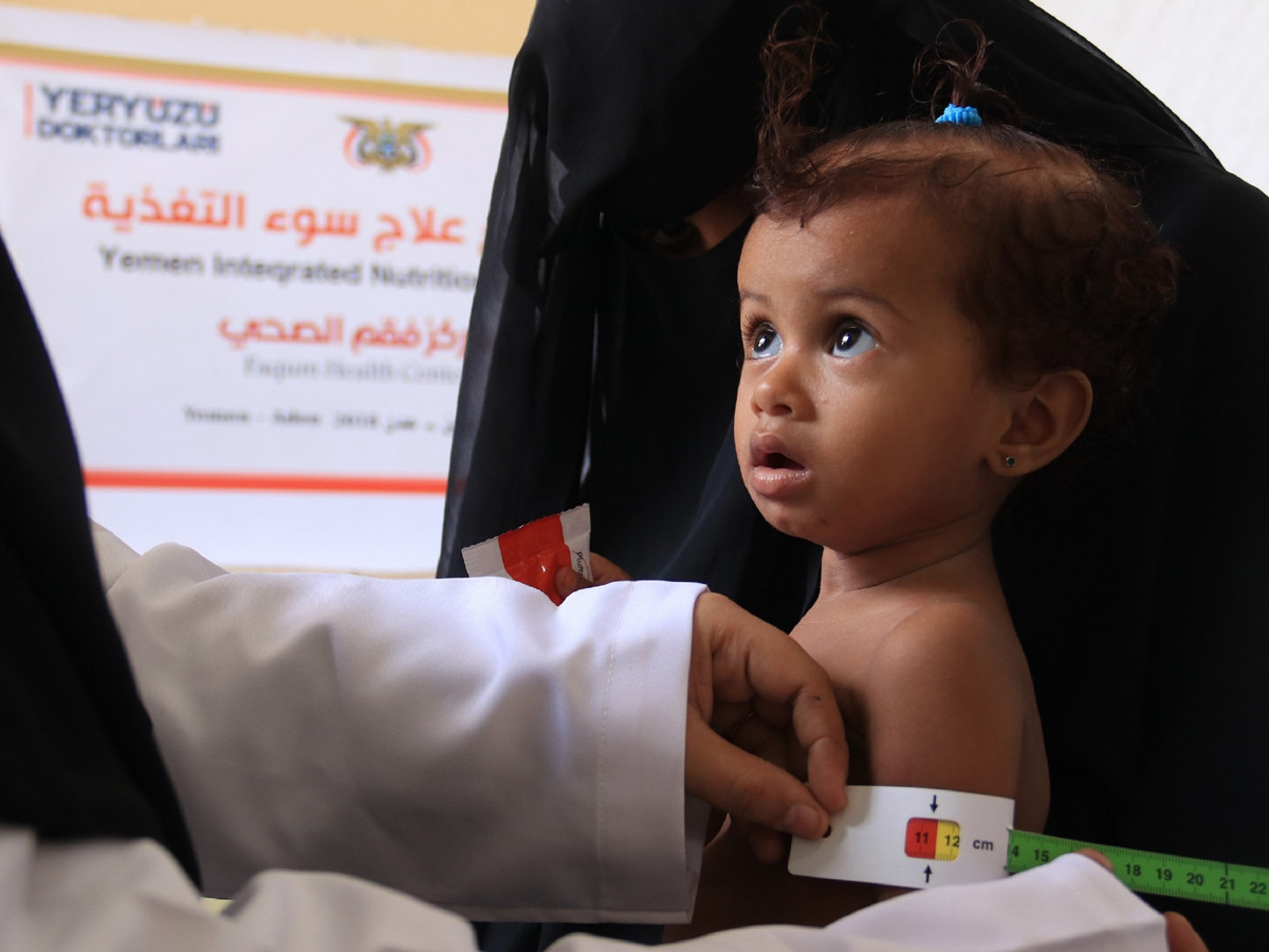 YEMEN İÇİN ACİL YARDIMA BEKLENİYORSUNUZ